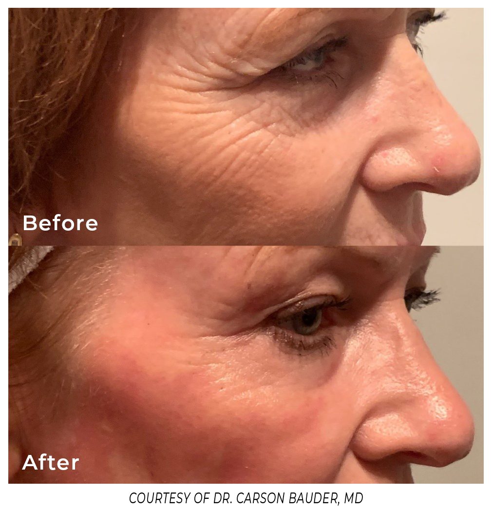 Phoenix-Dr-Carson-Before-and-After