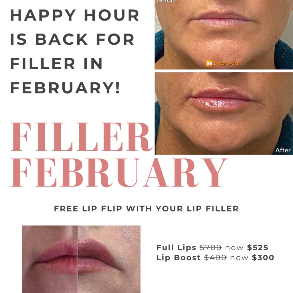Lip Filler February
