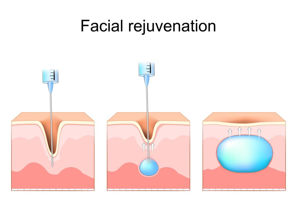 Facial Rejuvenation Skin